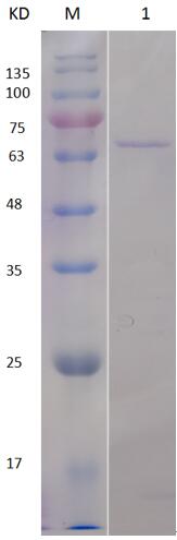 12% SDS-PAGE analysis profiles of purified PA3115-485-919 (CBB stained).